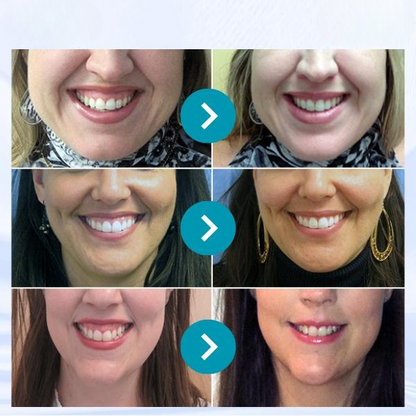DentiZen™ Gingival Therapy Gel