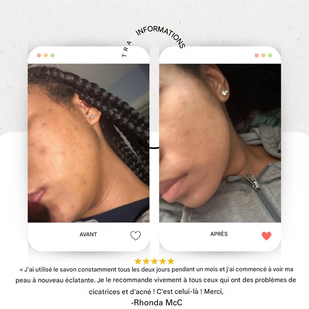 Savon Éclat Curcuma
